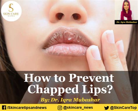 How To Prevent Chapped Lips