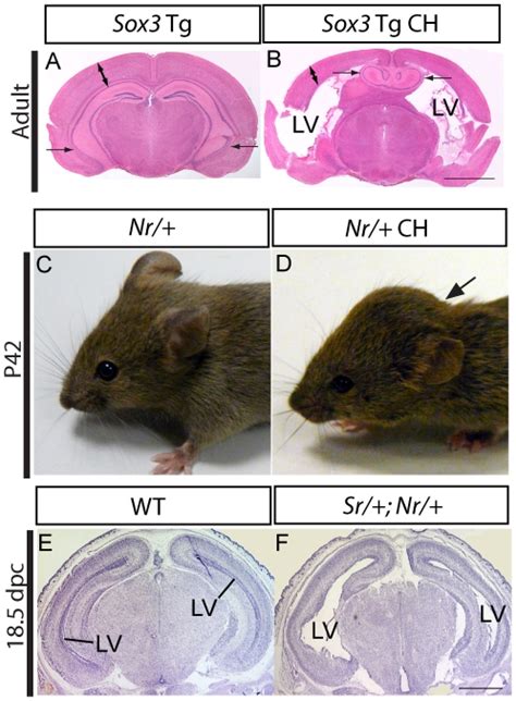 A B H E Stained Coronal Section Of Adult Sox Transgenic Mouse Brain