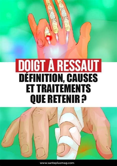 Doigt à ressaut définition causes et traitements que retenir en