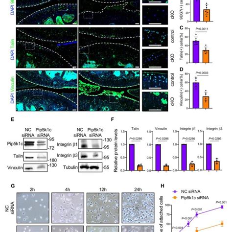 Pip K C Loss Causes Ecm Degradation And Chondrocyte Hypertrophic