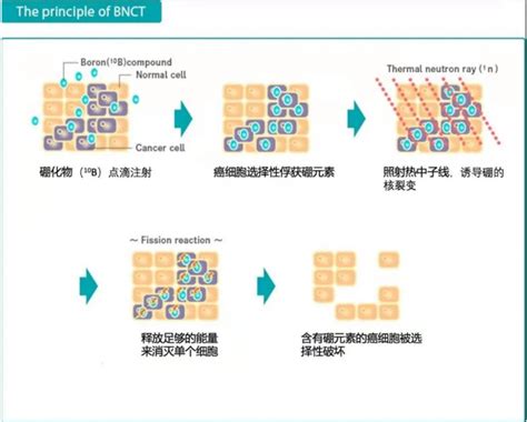 硼中子俘获疗法 BNCT 硼中子俘获疗法临床试验 盛诺一家