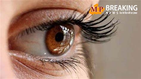 World Glaucoma Day 2024 आंखों की रोशनी छीन लेता है ग्लूकोमा जानिए