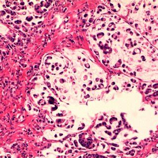 Histological characteristics. Hematoxylin and eosin stain indicated... | Download Scientific Diagram