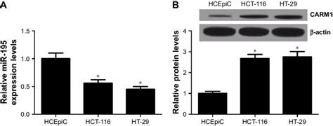 The Expression Of Mir And Carm In Crc Cell Lines Hct And