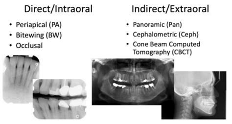 B Types Of Radiographs Flashcards Quizlet