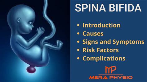 Spina Bifida Intro Causes Signs And Symptoms Risk Factors