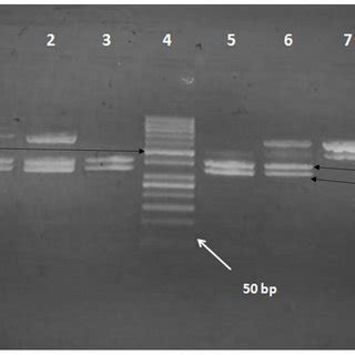 Multiplex PCR For Amplification Of K Pneumoniae Virulence Genes On