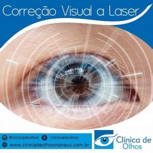 Dicas Clinica De Olhos Cl Nica De Olhos Manaus