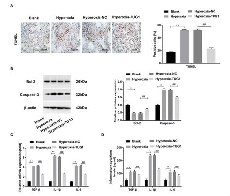 Overexpression Of Tug Inhibits Apoptosis And Inflammation In Lung