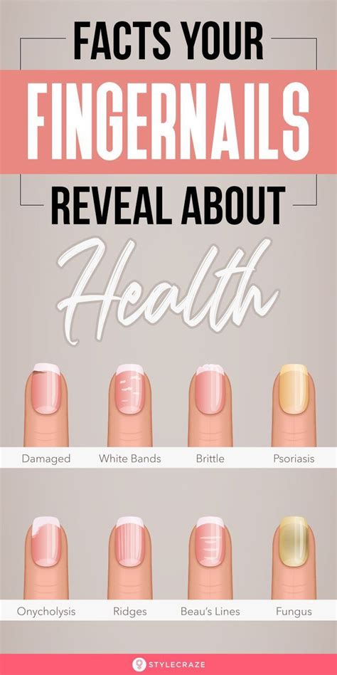 8 Important Signs Your Fingernails Can Tell About Your Health Artofit