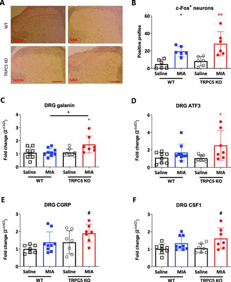 Greater Dorsal Horn Neuron Activation In The Lumbar Spinal Cord And