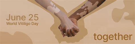 June 25 World Vitiligo Day Vitilsi