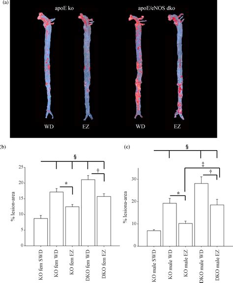 Ezetimibe Potently Reduces Vascular Inflammation And Arteriosclerosis