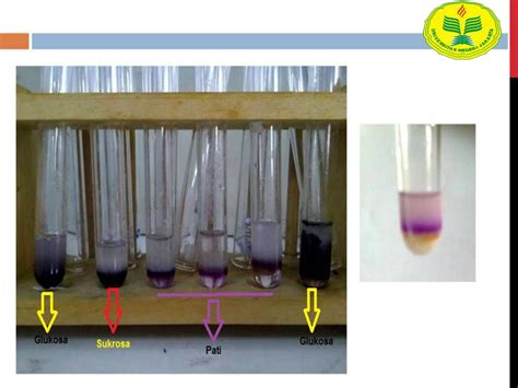 Ppt Uji Karbohidrat Ppt