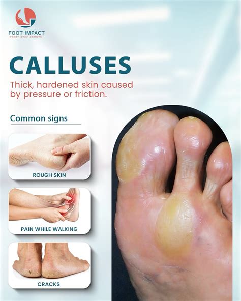 FootImpact Podiatry Clinic | Mumbai