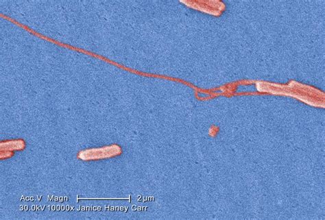 Legionella pneumophila - wikidoc