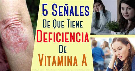 Los Diferentes Tipos De Vitamina A