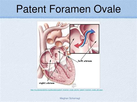 Ppt Fetal Circulation Powerpoint Presentation Free Download Id 5388525