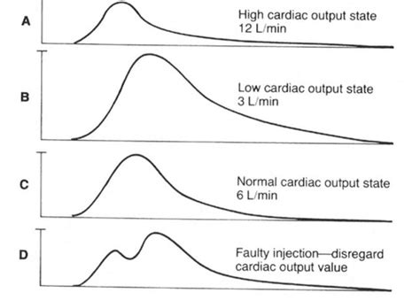 Cardiac Output Monitoring Invasive Exam 3 Flashcards Quizlet