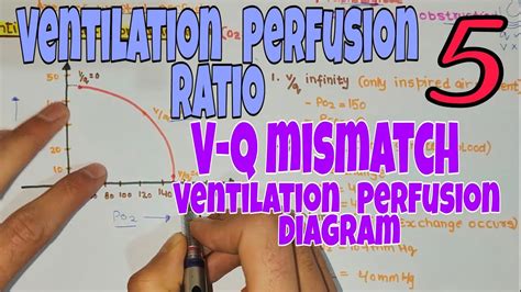 Ventilation Perfusion Ratio V Q Mismatch Ventilation Perfusion