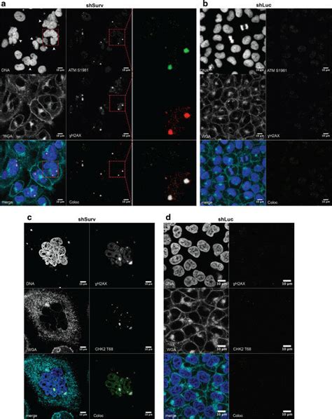 Activation Of ATM And CHK2 At DNA Lesions In SBC 2 Cells With Knockdown