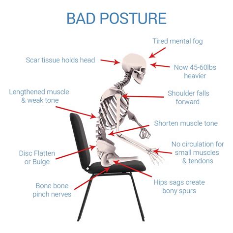 Posture Correction Cushion For Back Support | SITTS