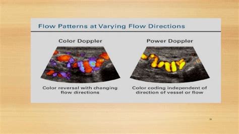 Doppler Effect - Ultrasound