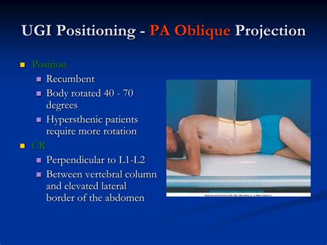 PPT - Radiography of the GI System PowerPoint Presentation - ID:280707