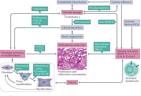 Scleroderma renal crisis and renal involvement in systemic sclerosis ...