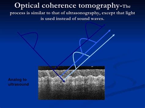 Optical Coherence Tomography - principle and uses in ophthalmology