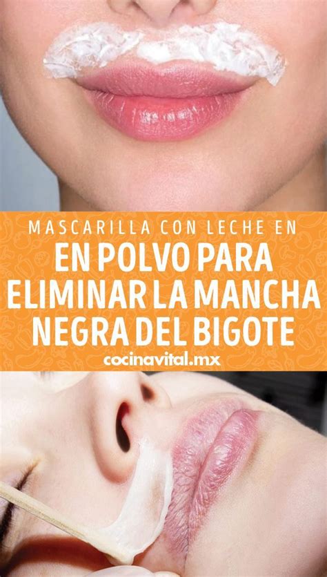 Te Incomoda Tener Esa Mancha Negra En El Labio Superior Aplica Esta