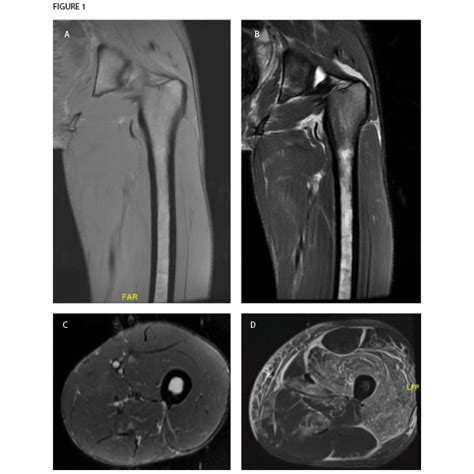 Case Review Mri Leads To Non Rheumatic Diagnosis Surprise Page 3 Of