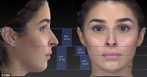 Women Using Plastic Surgery To Achieve Meghan Markles Golden Ratio