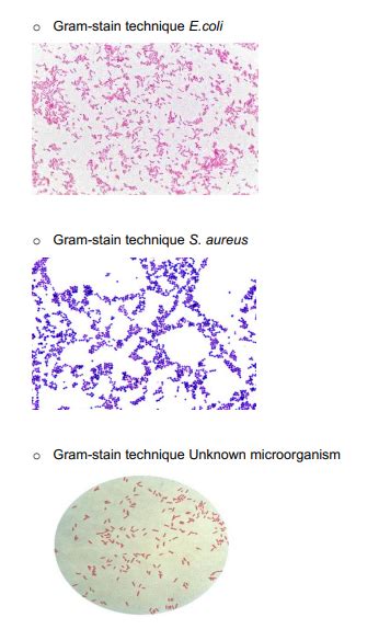 √100以上 E Coli Morphology Gram Stain 283207 Li Gram Stain Morphology And Arrangement