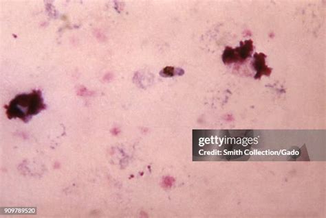 Micrograph Blood Smear Photos And Premium High Res Pictures Getty Images