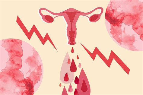Period Pain: Types, Causes, and Treatments