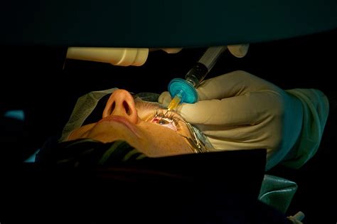 Mengenal Operasi Lasik Mata Untuk Menajamkan Penglihatan Mata Minus