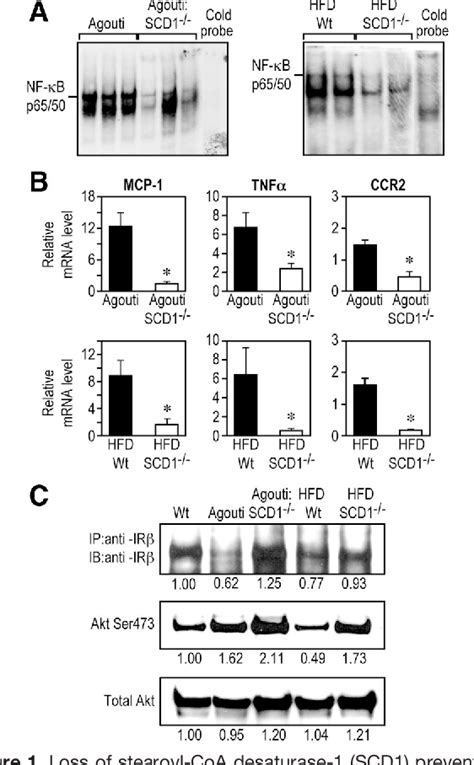 Figure 1 From Loss Of Stearoyl Coa Desaturase 1 Attenuates Adipocyte