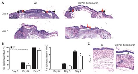 JCI - Collagen VII plays a dual role in wound healing