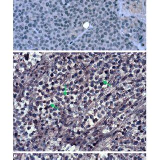 Tumor SpeciWc T Cell Cytotoxicity P Phase And R Phase CTVT Cells 8