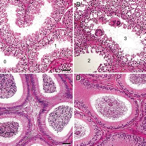 Transmission Electron Micrographs Of Testicular Sections From