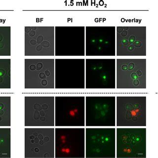 Localization Of Nhp6Ap GFP In Yeast Cells During Hydrogen Peroxide