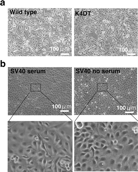 Morphologies Of Wild Type K Dt And Sv Immortalized Corneal