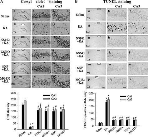 Neuroprotective Effects Of Drugs That Inhibit Bcl 2 Degradation Against