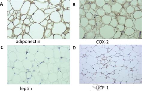 Immunohistochemistry Of Adiponectin A COX 2 B Leptin C And