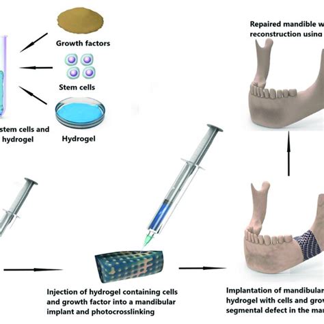 Combination Of Scaffold Made Of Different Biomaterials And Hydrogel Download Scientific Diagram