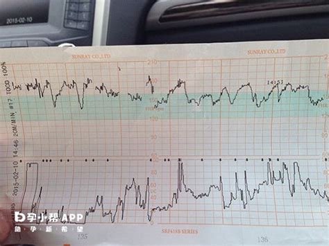 胎心150以上女孩几率大孕后期胎心率看男女的方法全解 名医在线
