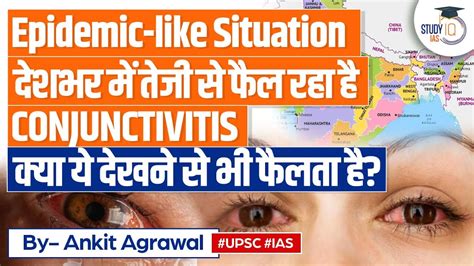 Conjunctivitis Epidemic In Delhi Prevention And Precautions For Eye