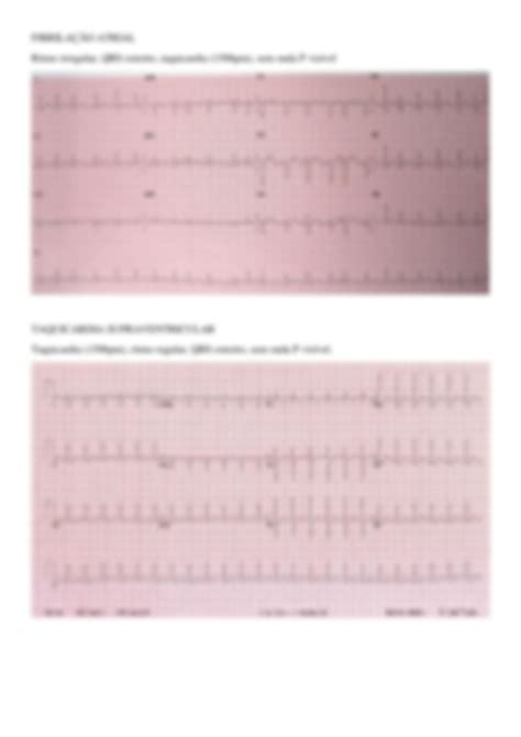 SOLUTION Aula 3 Ecg Studypool