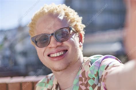 Young albino man smiling - Stock Image - F037/9639 - Science Photo Library